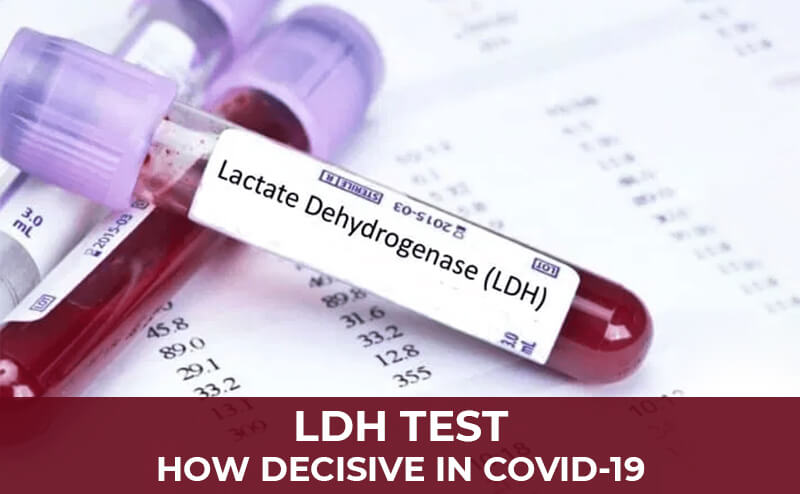 LACTATE DEHYDROGENASE TEST (LDH) - HOW DECISIVE IN COVID-19